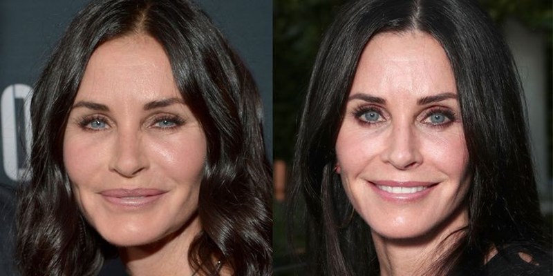 Courteney Cox: Γιατί αποφάσισε να αφαιρέσει το botox; - εικόνα 3