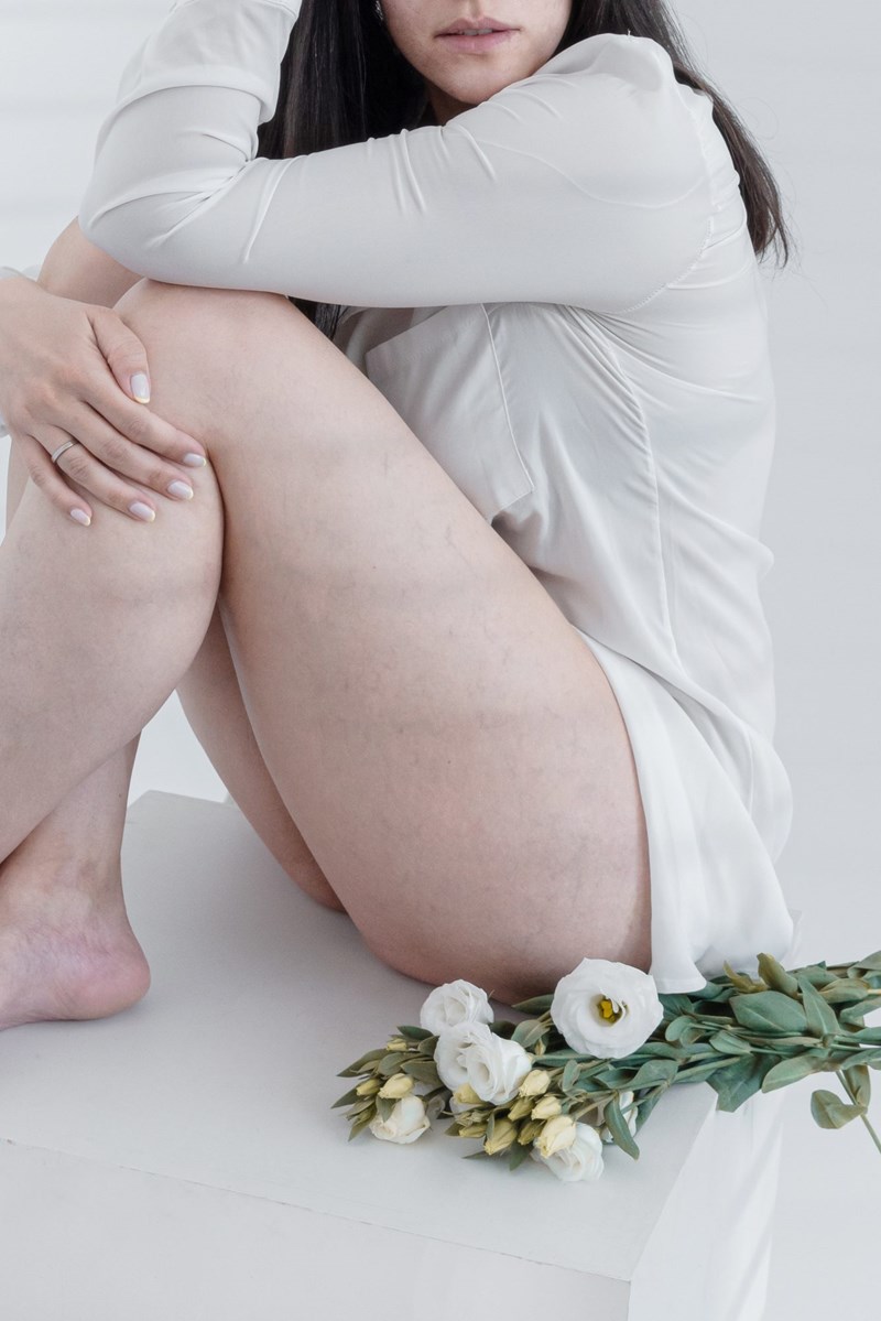 Καθρέφτη, Καθρεφτάκι μου: Οι editors του ELLE.gr μιλούν για τις «ατέλειες» που τις κάνουν πιο δυνατές - εικόνα 2