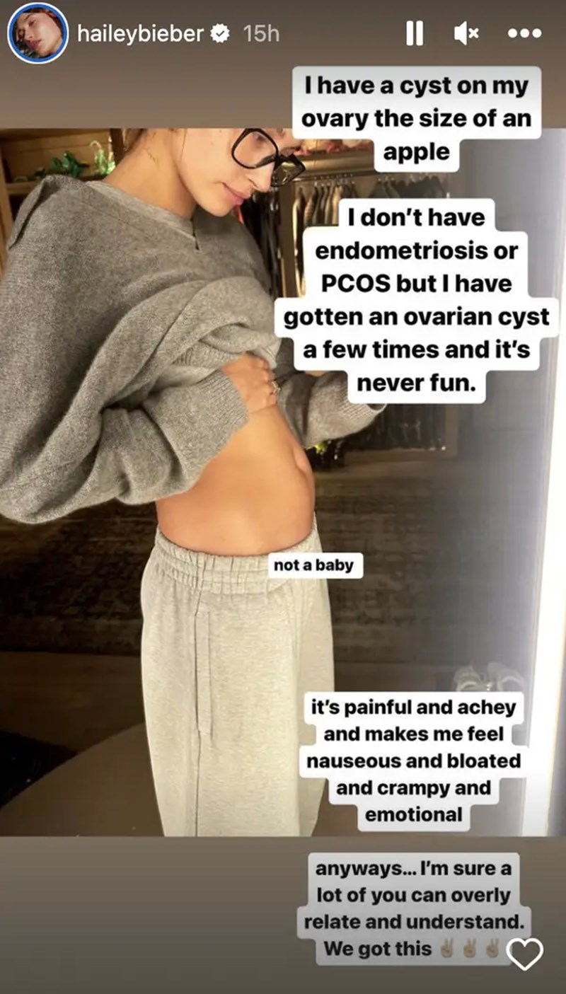 Hailey Bieber: Αποκάλυψε ότι υποφέρει από κύστη στις ωοθήκες στο μέγεθος μήλου - εικόνα 1