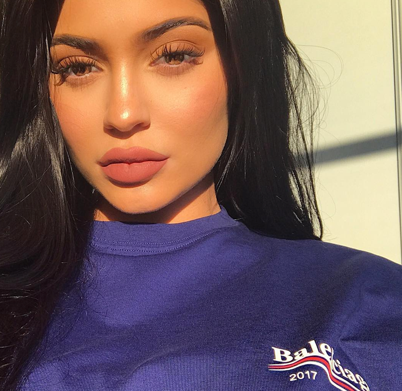 Fillers στα χείλη: Τι να προσέξεις; - εικόνα 1