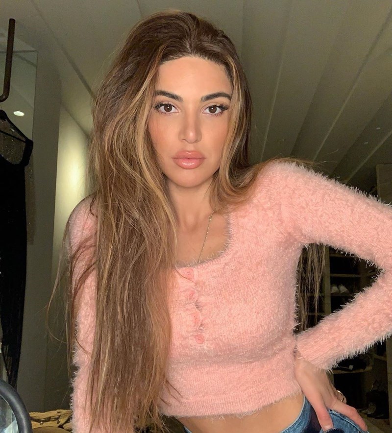 Διεσταλμένοι πόροι: Πώς θα βελτιώσεις την όψη της επιδερμίδας σου - εικόνα 1