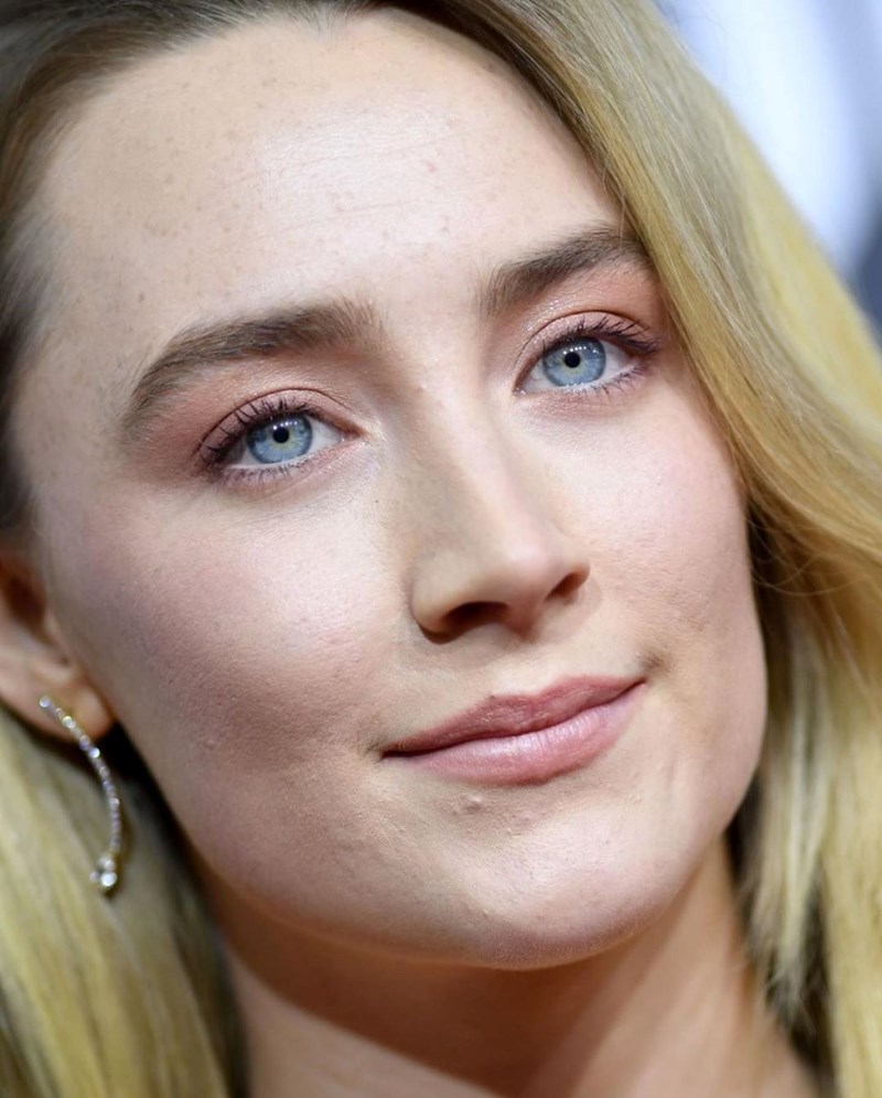 Skin Positivity: Το κίνημα που θα σε κάνει να αγαπήσεις τις ατέλειές σου - εικόνα 1