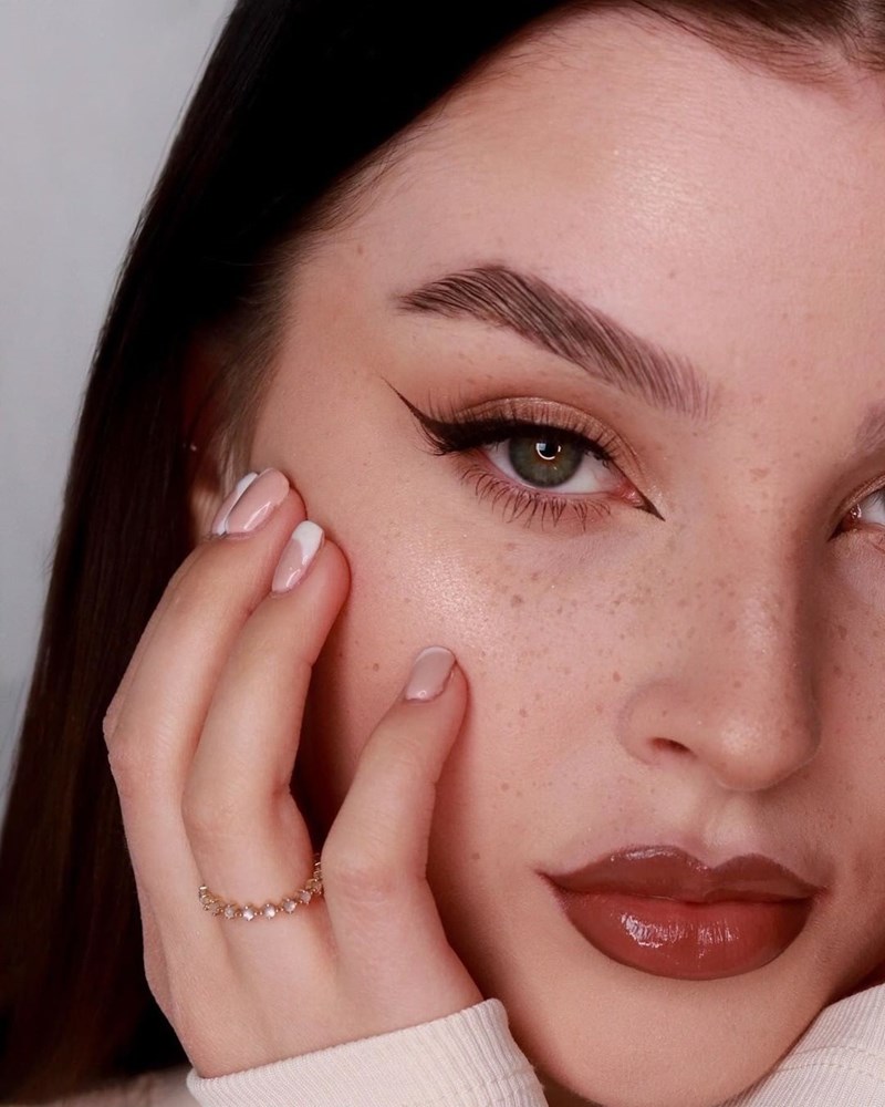 Brow lift