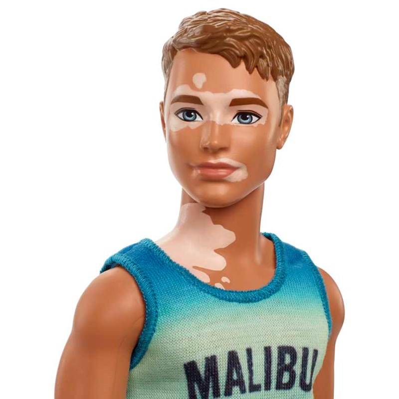 Η πρώτη Barbie κούκλα με ακουστικά βαρηκοΐας και ο Ken με λεύκη - εικόνα 2