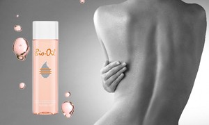 Η ΚΛΗΡΩΣΗ ΤΟΥ ΔΙΑΓΩΝΙΣΜΟΥ ΓΙΑ 10 ΠΡΟΪΟΝΤΑ BIO-OIL OΛΟΚΛΗΡΩΘΗΚΕ!