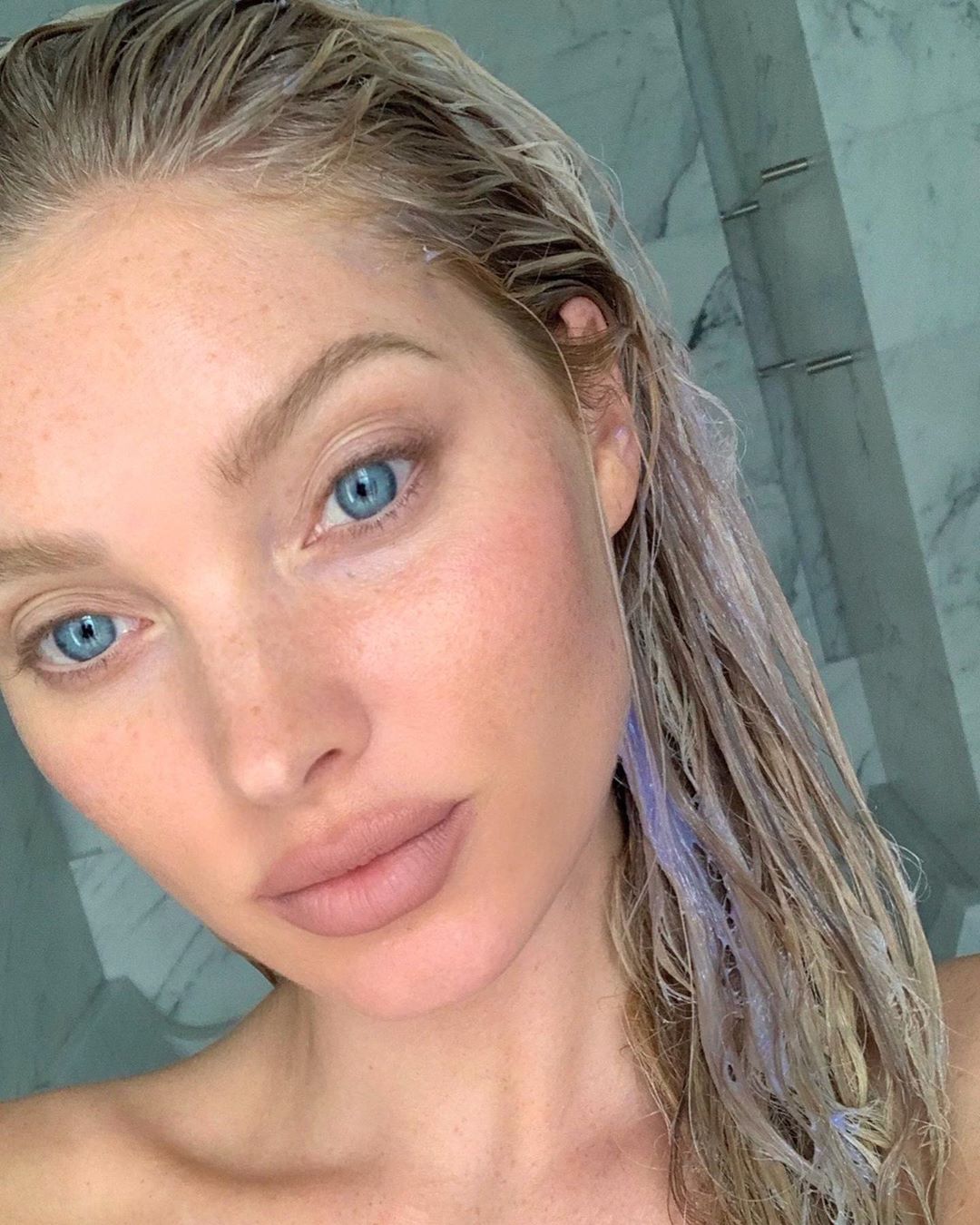 Πότε είναι η κατάλληλη στιγμή να ξεκινήσω θεραπεία για τις πανάδες;