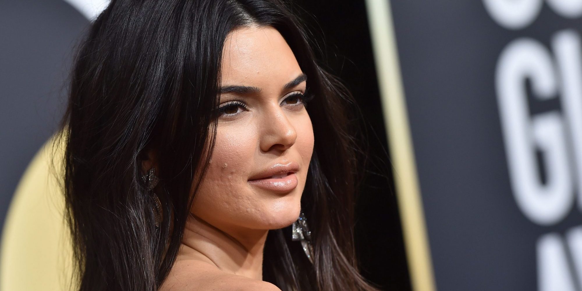 Οι beauty bloggers που δεν φοβούνται να δείξουν πως έχουν ακμή