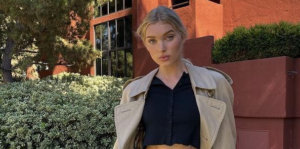 Elsa Hosk: Αποκαλύπτει το πρόβλημα που αντιμετωπίζει με τα μαλλιά της μετά την εγκυμοσύνη