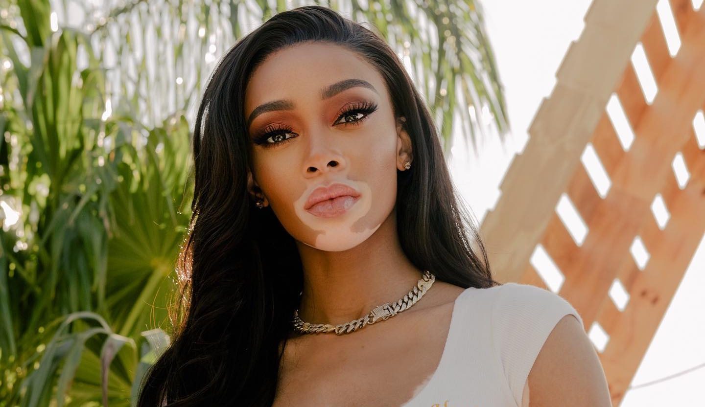 Winnie Harlow: Δημιούργησε το δικό της brand αντηλιακών