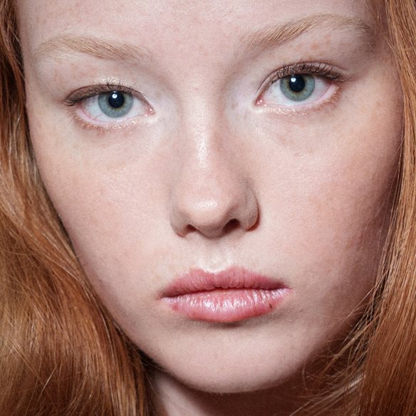 Ευαίσθητη & Ερυθρή Επιδερμίδα: Αυτά είναι τα 2 προϊόντα που θα σε σώσουν