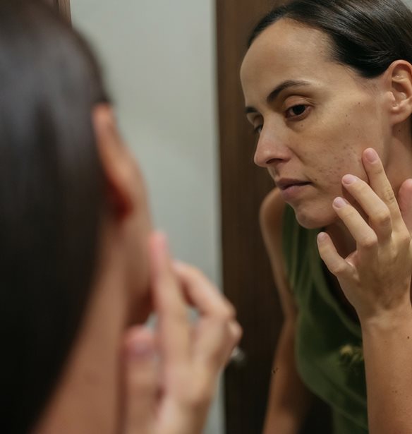 5 σημάδια ότι μπορεί να έχεις κάποια ορμονική διαταραχή