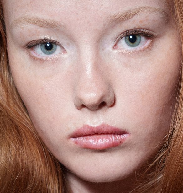 Ευαίσθητη & Ερυθρή Επιδερμίδα: Αυτά είναι τα 2 προϊόντα που θα σε σώσουν