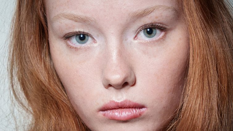 Ευαίσθητη & Ερυθρή Επιδερμίδα: Αυτά είναι τα 2 προϊόντα που θα σε σώσουν