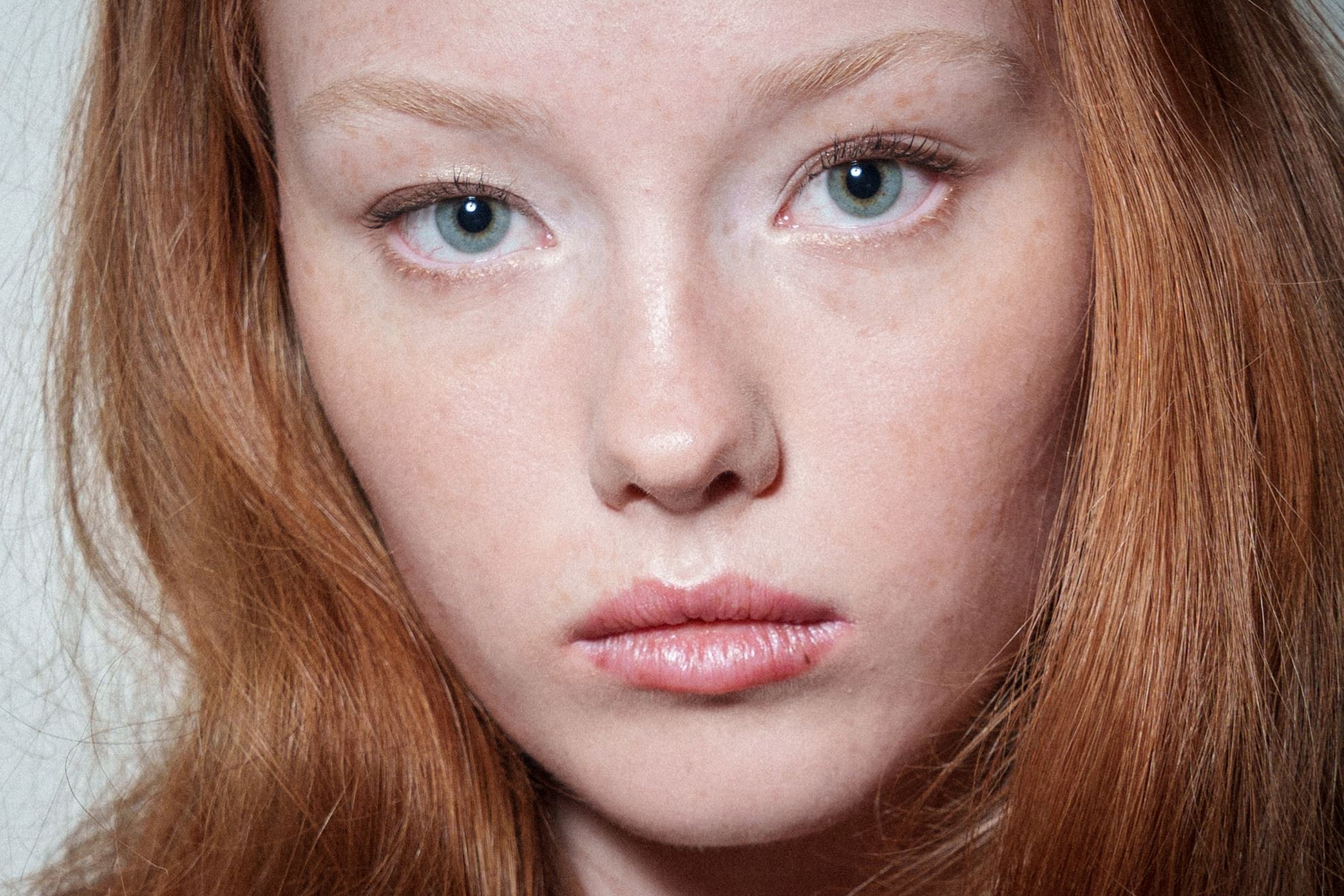 Ευαίσθητη & Ερυθρή Επιδερμίδα: Αυτά είναι τα 2 προϊόντα που θα σε σώσουν